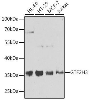 GTF2H3 Rabbit polyclonal antibody