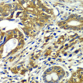 CDC16 Rabbit polyclonal antibody