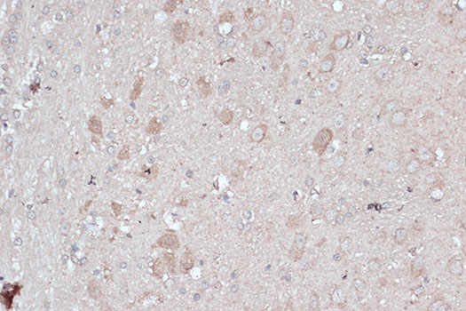 [KD Validated] LC3B Rabbit polyclonal antibody