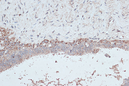 [KD Validated] LC3B Rabbit polyclonal antibody
