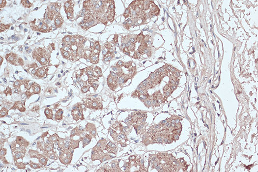 [KD Validated] LC3B Rabbit polyclonal antibody