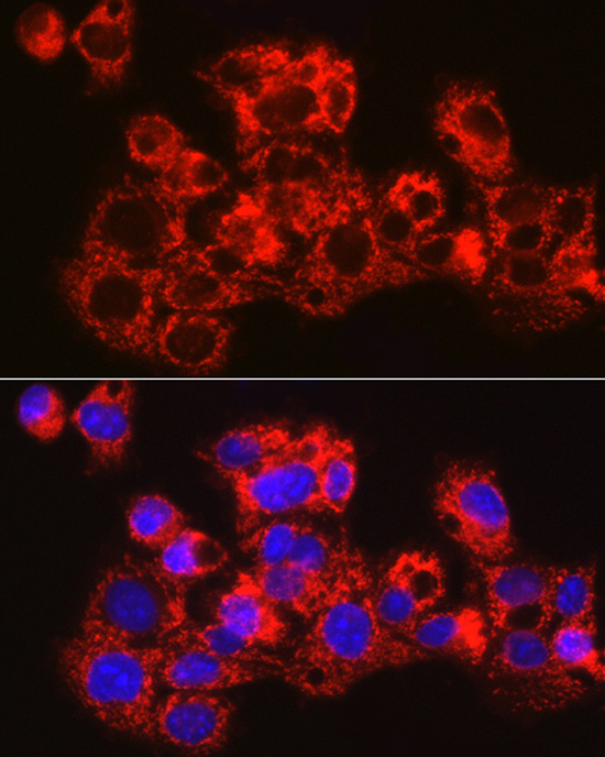 METTL7B Rabbit polyclonal antibody