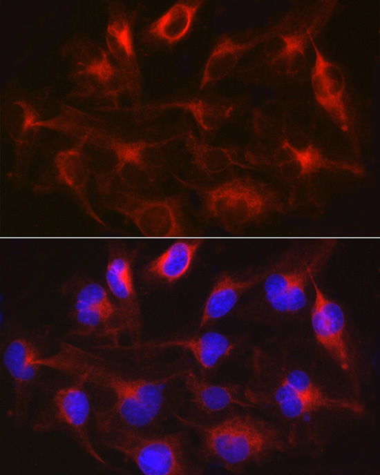 METTL7B Rabbit polyclonal antibody