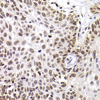 PHIP Rabbit polyclonal antibody