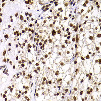 PHIP Rabbit polyclonal antibody