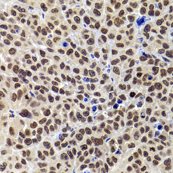 PHIP Rabbit polyclonal antibody