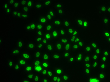 PHIP Rabbit polyclonal antibody