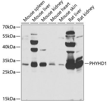 PHYHD1 Rabbit polyclonal antibody
