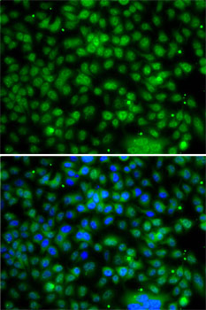 PHYHD1 Rabbit polyclonal antibody