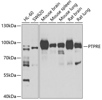 PTPRE Rabbit polyclonal antibody