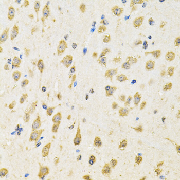 PTPRE Rabbit polyclonal antibody