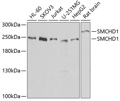 SMCHD1 Rabbit polyclonal antibody