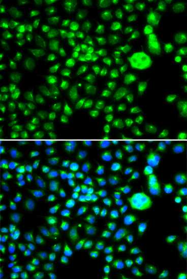 SMCHD1 Rabbit polyclonal antibody