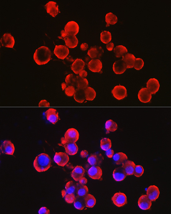 A Alpha-Synuclein Rabbit polyclonal antibody