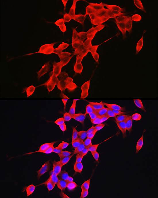 A Alpha-Synuclein Rabbit polyclonal antibody