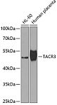 Western blot - TACR3 Rabbit pAb (A7220)