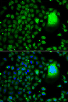 TAF5 Rabbit polyclonal antibody