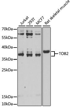 TOB2 Rabbit polyclonal antibody