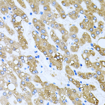 TOB2 Rabbit polyclonal antibody