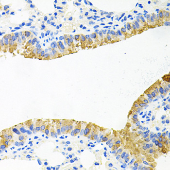 TOB2 Rabbit polyclonal antibody