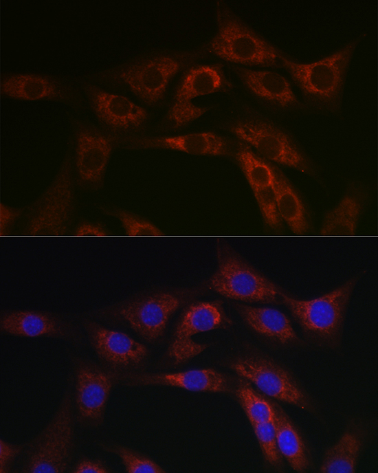 ABCA1 Rabbit polyclonal antibody