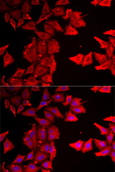 THRSP Rabbit polyclonal antibody