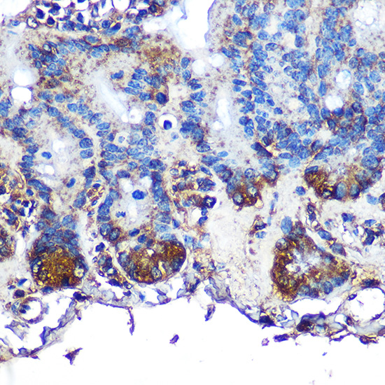 ITLN1 Rabbit polyclonal antibody