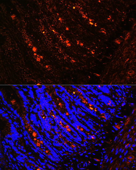 ITLN1 Rabbit polyclonal antibody