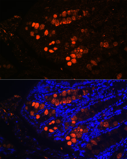 ITLN1 Rabbit polyclonal antibody