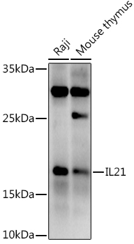 IL21 Rabbit polyclonal antibody