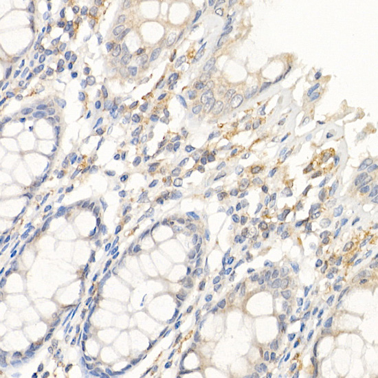 IL21 Rabbit polyclonal antibody
