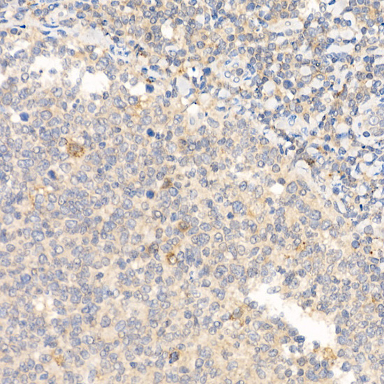 IL21 Rabbit polyclonal antibody