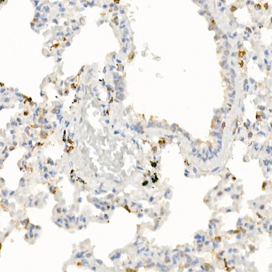 IL21 Rabbit polyclonal antibody