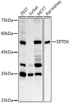 SETD6 Rabbit polyclonal antibody