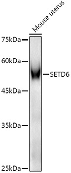 SETD6 Rabbit polyclonal antibody