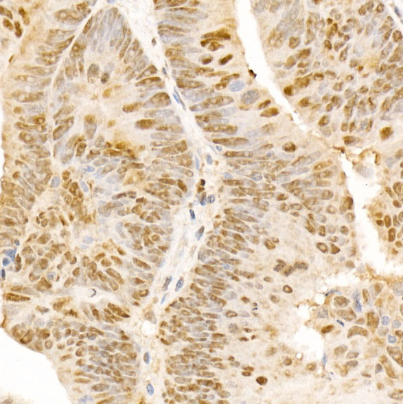 POLD3 Rabbit polyclonal antibody