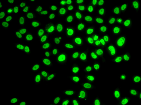 POLD3 Rabbit polyclonal antibody
