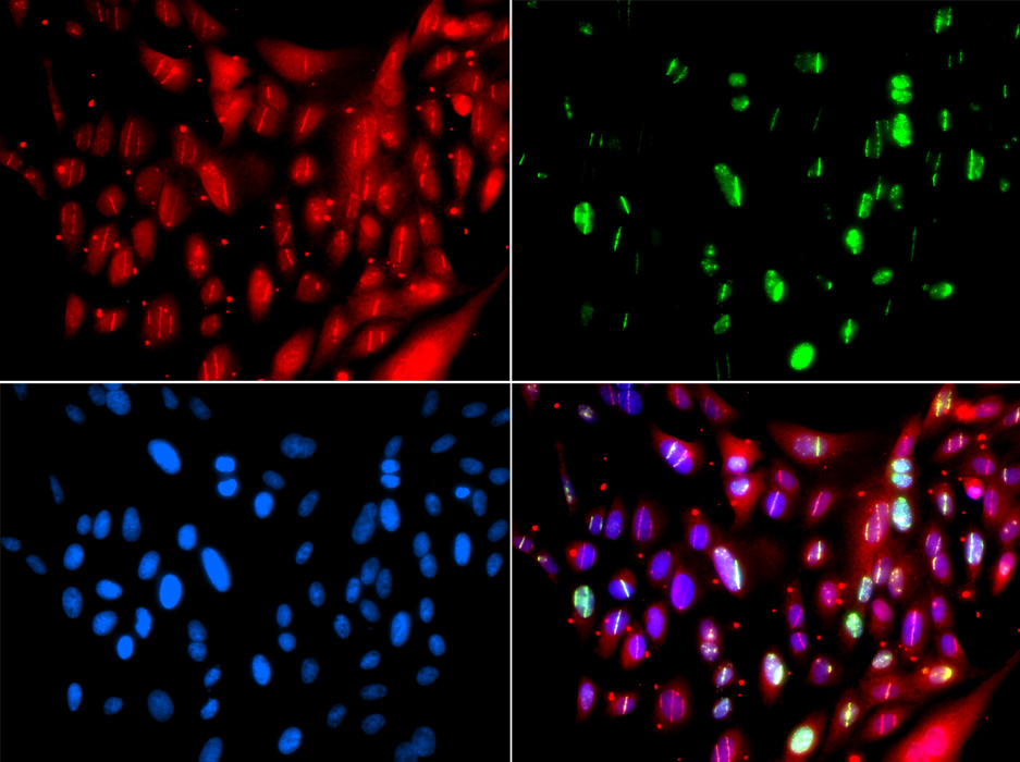 UIMC1 Rabbit polyclonal antibody