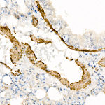 Western blot - α-Smooth Muscle Actin (ACTA2) Rabbit pAb (A7248)