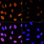 Western blot - Acetyl-Histone H3-K14 Rabbit pAb (A7254)