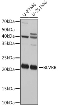BLVRB Rabbit polyclonal antibody