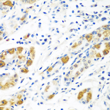 BLVRB Rabbit polyclonal antibody