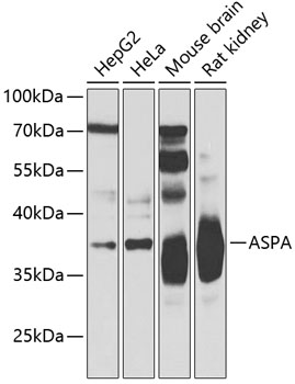 ASPA Rabbit polyclonal antibody