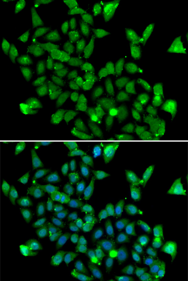 ASPA Rabbit polyclonal antibody