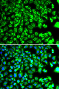 C10orf32 Rabbit polyclonal antibody