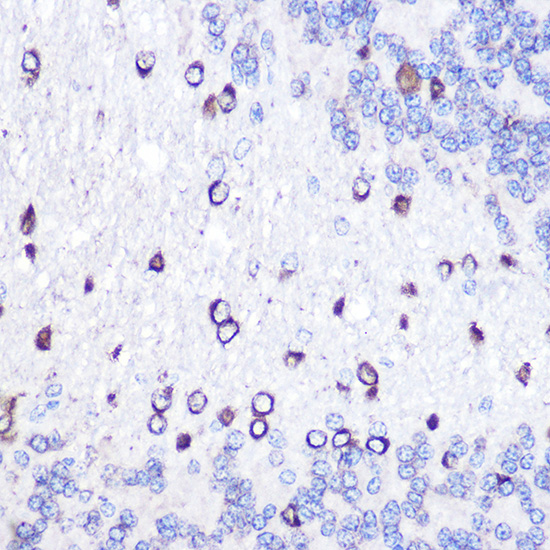 GOLPH2 Rabbit polyclonal antibody