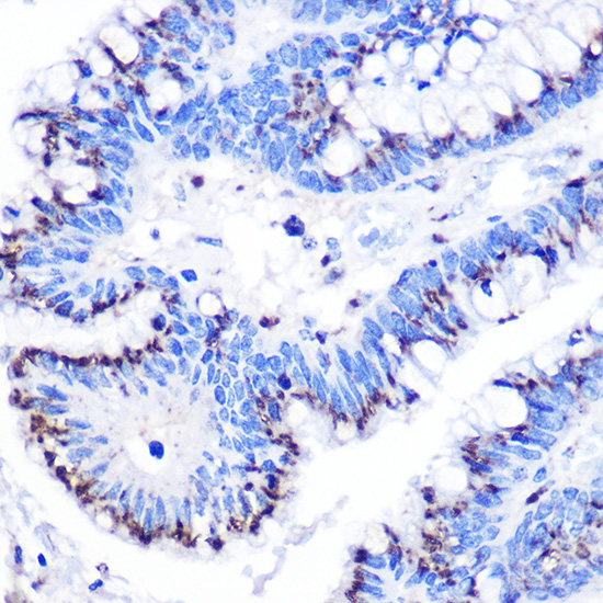 GOLPH2 Rabbit polyclonal antibody