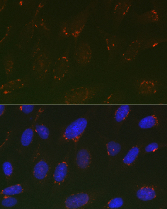 GOLPH2 Rabbit polyclonal antibody