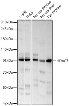 HDAC7 Rabbit polyclonal antibody
