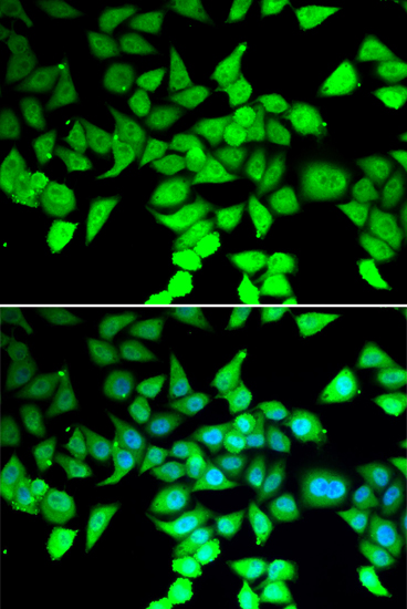 HDAC7 Rabbit polyclonal antibody